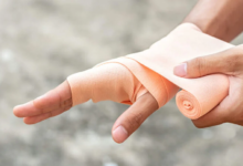 5 Tips to Care for Your Wrist Pain
