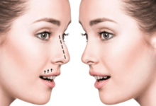Nose Job