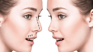 Nose Job