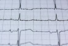 stellar pulse apex beam